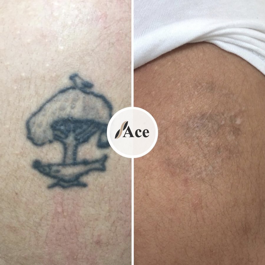 Ace Aesthetics - Ace Aesthetics